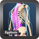 Recognize Kyphosis Disease APK