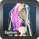 Recognize Kyphosis Disease icono