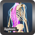 Recognize Kyphosis Disease ikon
