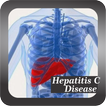 Recognize Hepatitis C Disease