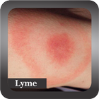 Recognize Lyme Disease アイコン