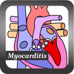 Recognize Myocarditis Disease