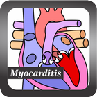 Recognize Myocarditis Disease icon