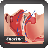 Recognize Snoring Disease simgesi