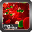 Recognize Sepsis Infection