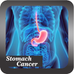 Recognize Stomach Cancer