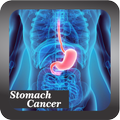 Recognize Stomach Cancer