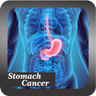 Recognize Stomach Cancer ikona