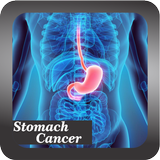 Recognize Stomach Cancer-icoon