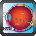 Recognize Uveitis ไอคอน