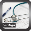 Recognize Vitiligo disease