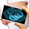 Icona Ultrasound Scanner