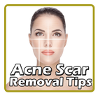 Acne Scar Removal Tips icône