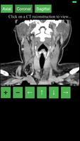 CT Neck ภาพหน้าจอ 1