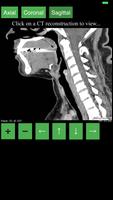 CT Neck capture d'écran 2