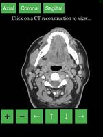 CT Neck ảnh chụp màn hình 3