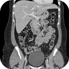 CT Abdomen Pelvis icône