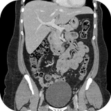 CT Abdomen Pelvis aplikacja