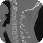 CT Cervical Spine icône