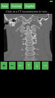 CT Cervical Spine capture d'écran 1