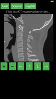 CT Cervical Spine capture d'écran 2