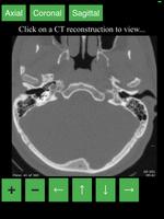 CT Cervical Spine capture d'écran 3