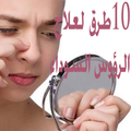 10 طرق لعلاج الرؤوس السوداء نهائيا
