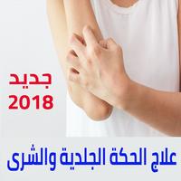 علاج الحكة والحساسية Affiche