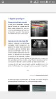 ATLAS Echographie d’Urgence et Réanimation 截图 3