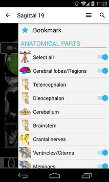 Imaios E Anatomy Apk Cracked Imaios E Anatomy Apk Cracked