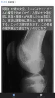 理学療法士(PT) 資格 国家試験対策 過去問で模擬試験 تصوير الشاشة 1