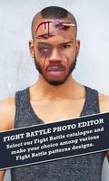 Fake Injury Photo Editor : Bruised Face screenshot 2
