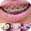 Braces Booth Pro