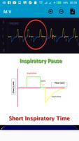 mechanical ventilation advanced screenshot 2