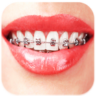 Braces: Real Teeth Braces Pict Zeichen