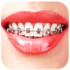 Braces: Real Teeth Braces Pict آئیکن