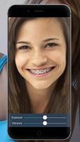 برنامه‌نما Braces: Real Teeth Braces Pict عکس از صفحه