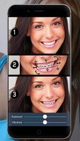 Braces: Real Teeth Braces Pict ภาพหน้าจอ 2