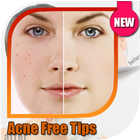 Acne Free Tips ikona