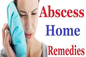 Abscess Home Remedies 截图 2