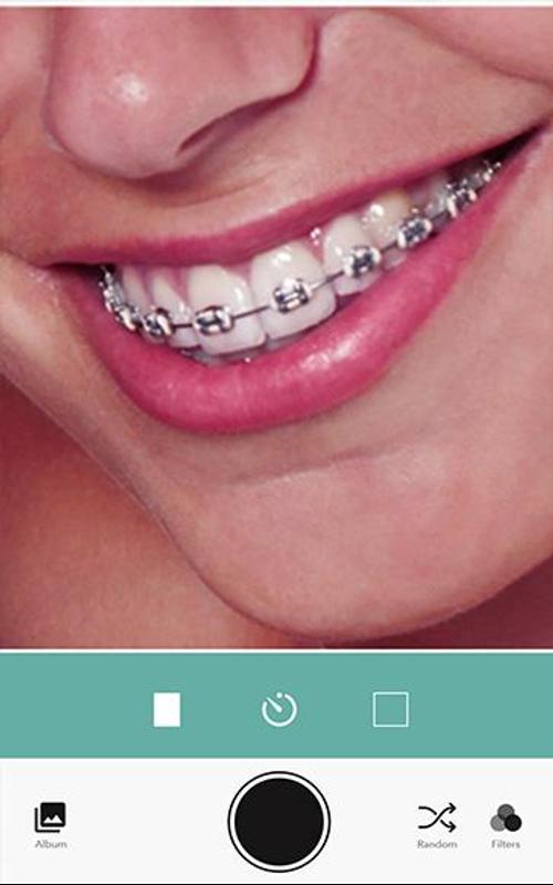 real braces teeth booth apk download free photography app for