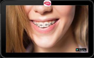 Teeth Braces Photo Collage capture d'écran 3