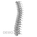 OsteoAlarm Free