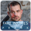 Fake Injuries Prank