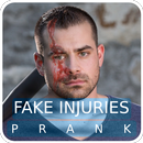 Fake Injuries Prank APK