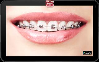 Braces Camera Photo Editor ảnh chụp màn hình 3