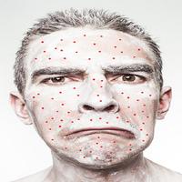 پوستر Pimple Removal Tips