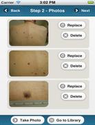 DermAID screenshot 7