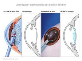 1 Schermata Oftalmología