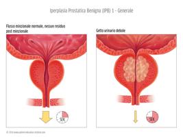 SIU, Urologia, tablet app plakat